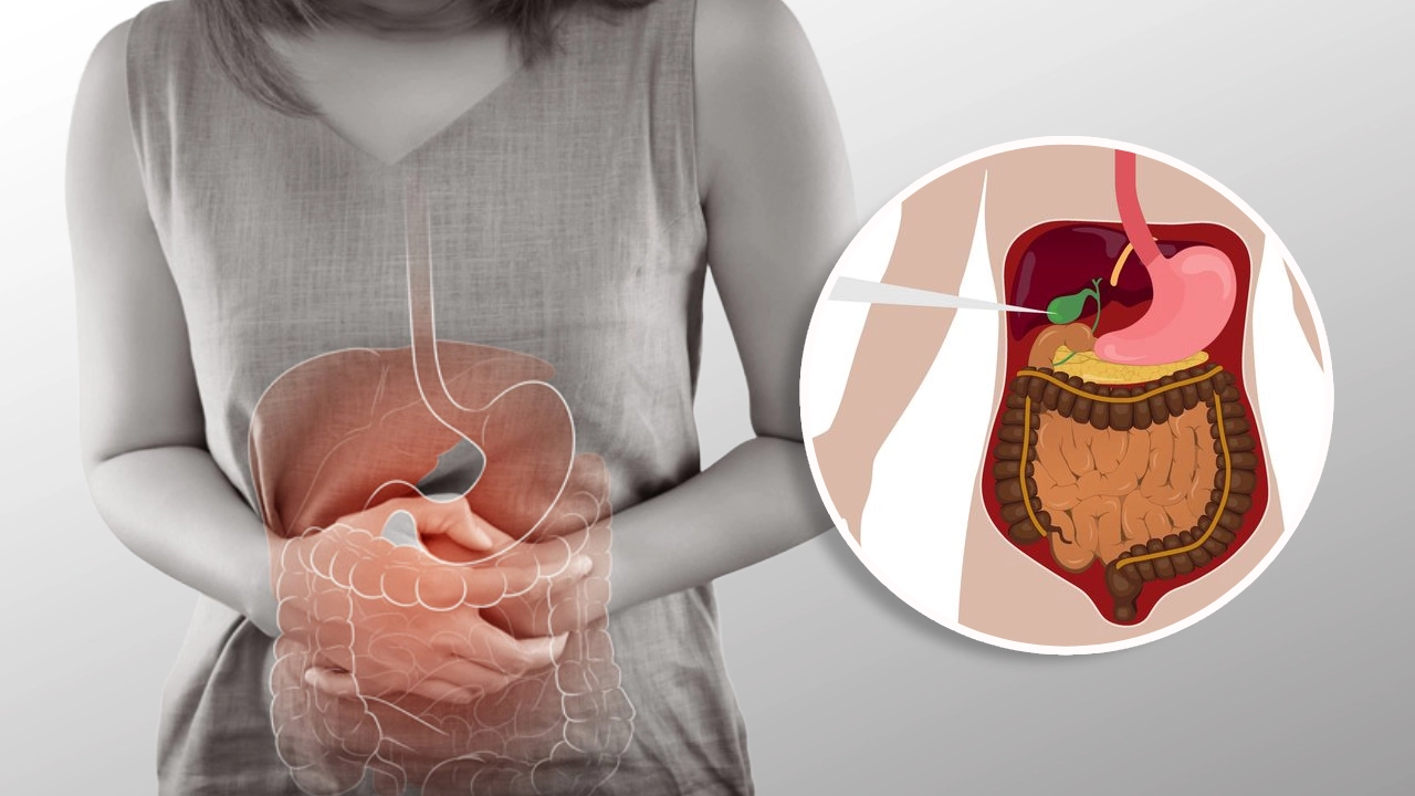 Gallbladder stones diagnosis and treatment at GEM Hospitals